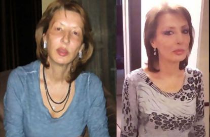 გაიკეთა თუ არა ქეთა თოფურიას დედამ პლასტიკური ოპერაციები?