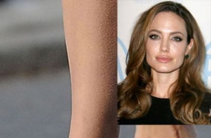 ცნობილი ლამაზმანების შოკისმომგვრელი ფეხის ტერფები