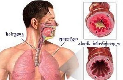 უებარი საშუალება სასუნთქი გზების და ბრონქიტის სამკურნალოდ