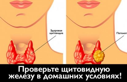 როგორ შევიმოწმოთ ფარისებრი ჯირკვალი დამოუკიდებლად