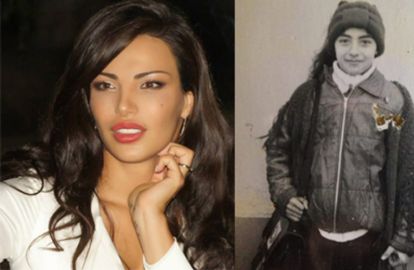 შორენა ბეგაშვილმა ''პლასტიკური ოპერაციამდელი'' და ბავშვობის ფოტოები გამოაქვეყნა