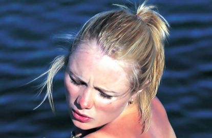 სახლში მომზადებული სასწაულმოქმედი 6 ლოსიონი დამწვრობის სამკურნალოდ