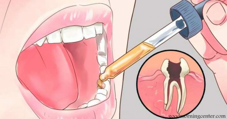 როგორ მოიხსნათ კბილის ნებისმიერი ტკივილი სულ ერთ წუთში 