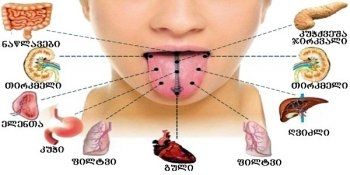 შეისწავლეთ თქვენი ენა - მასზე დაკვირვება ბევრ დაავადებას გაგიმხელთ