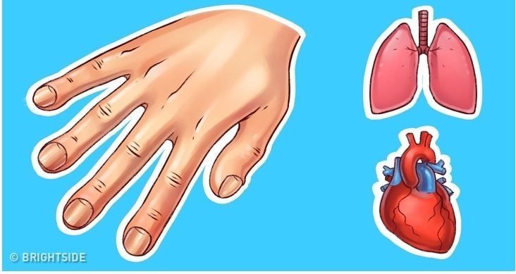 ჯანმრთელობის  7 პრობლემა, რომელთა შესახებაც  ჩვენი  ხელები გვაფრთხილებენ