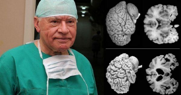 ნევროლოგები განგაშს ტეხენ! ყველა ქალმა უნდა გაითვალისწინოს ეს რჩევა...