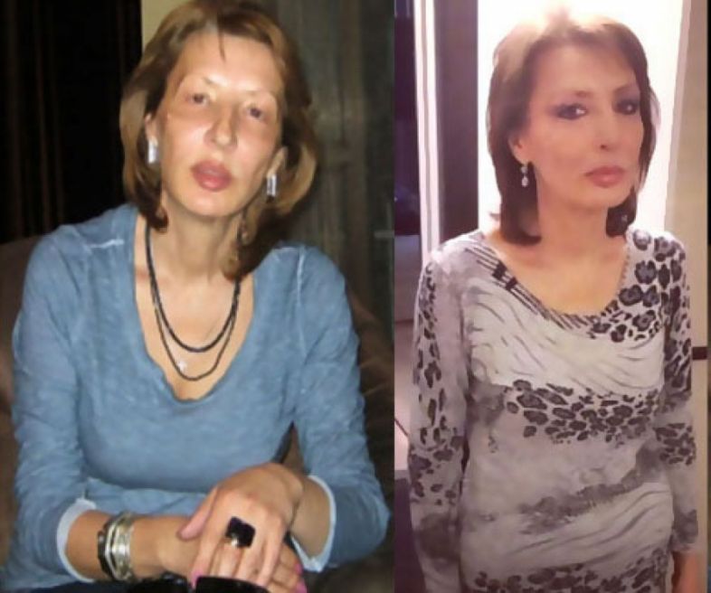 გაიკეთა თუ არა ქეთა თოფურიას დედამ პლასტიკური ოპერაციები?