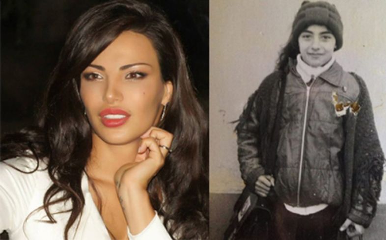 შორენა ბეგაშვილმა ''პლასტიკური ოპერაციამდელი'' და ბავშვობის ფოტოები გამოაქვეყნა